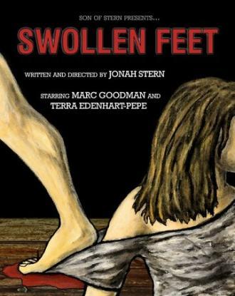 Swollen Feet